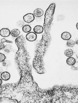 فيروس هاناتا