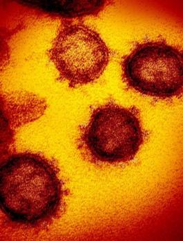 لماذا لا يموت كورونا في الصيف