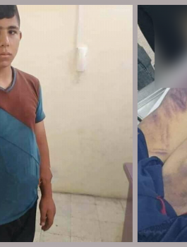 مقتل طفل على قريب له في غزة
