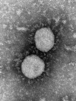 طفرة الدلتا