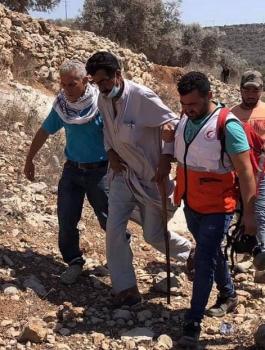 اصابات في بيتا