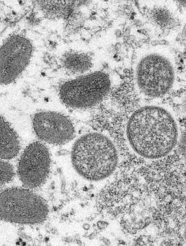 اسرائيل والجدري