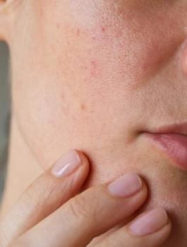 العلامات في الوجه والمرض الخطير