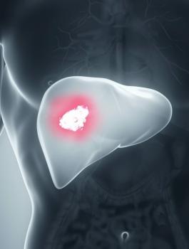 مرض السرطان