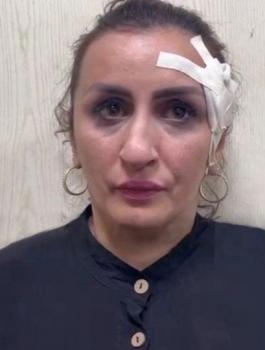 ام تبيع طفلها لاجراء عمليات تجميل