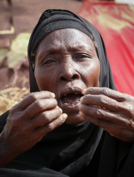 الفقراء في العالم