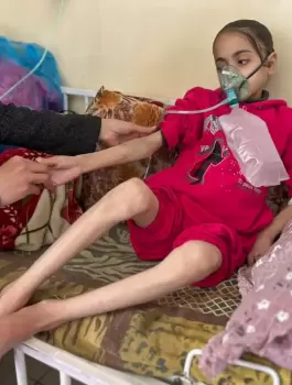 202404mena_palestine_gaza_n_malnutrition.webp