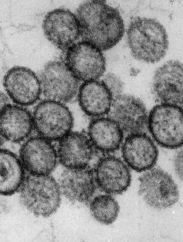 hantavirus.jpg