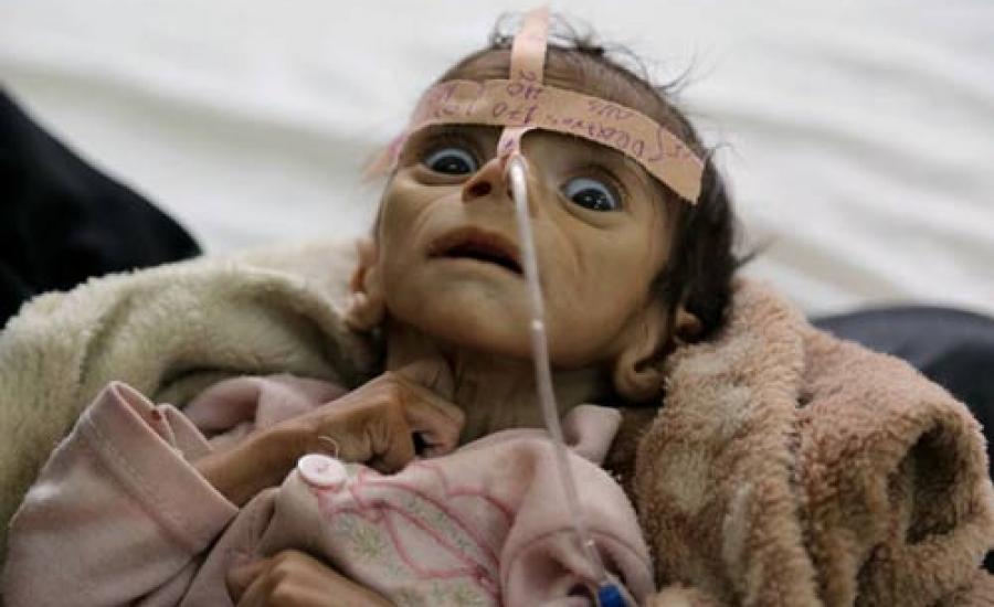 مجاعة في اليمن 