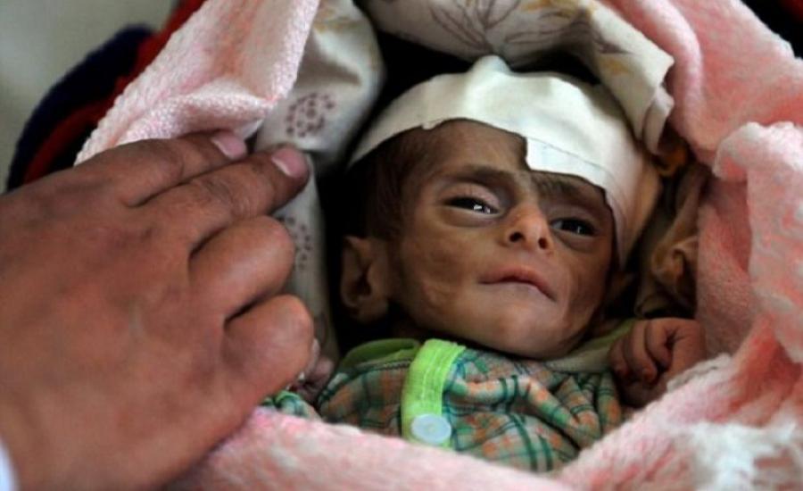 مقتل اطفال في اليمن 