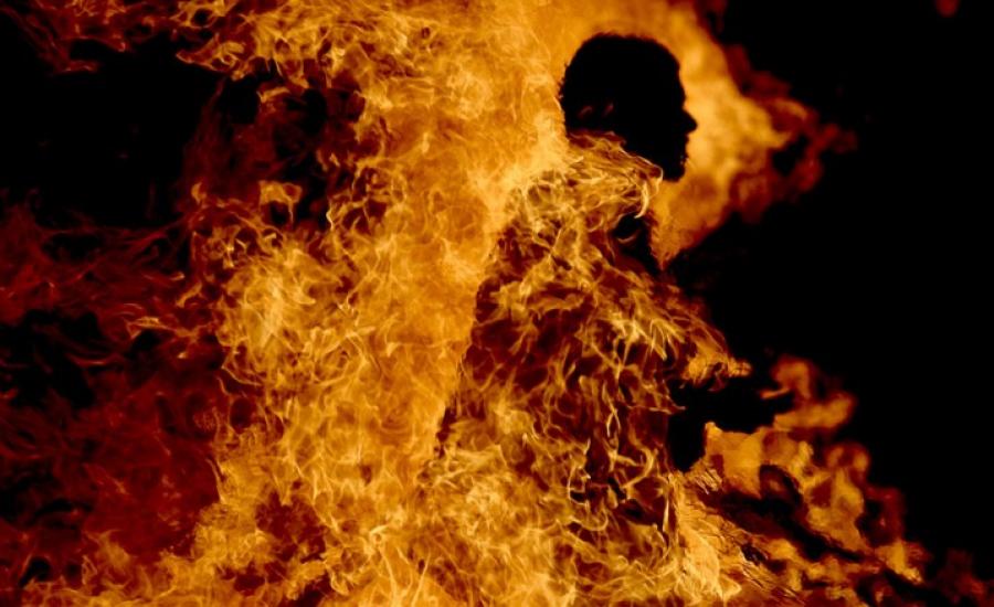شاب يشعل النار بجسده في الخليل 