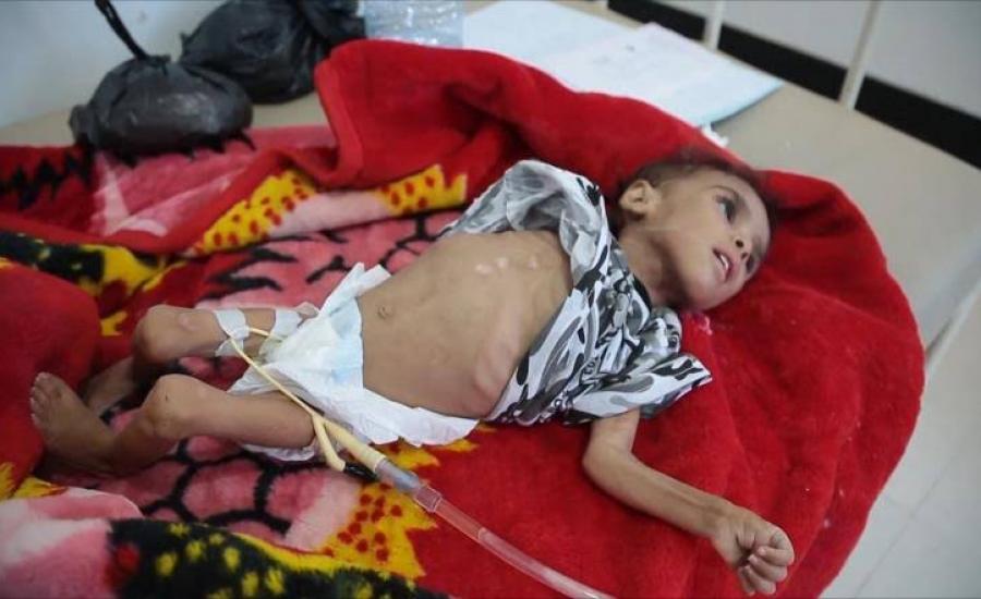  1500 وفاة بسبب الكوليرا في اليمن