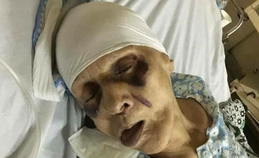 وفاة مسنة مصرية بعد تعرضها للتعذيب من قبل ابنها 