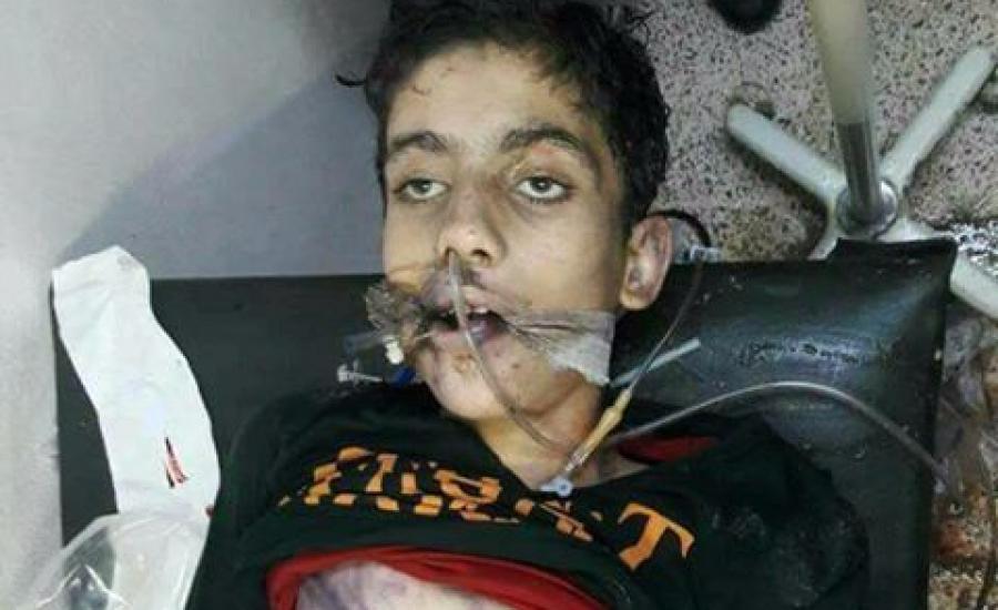 مقتل طفل سوري على يد خاله ضربا بسيخ حديدي حتى الموت 
