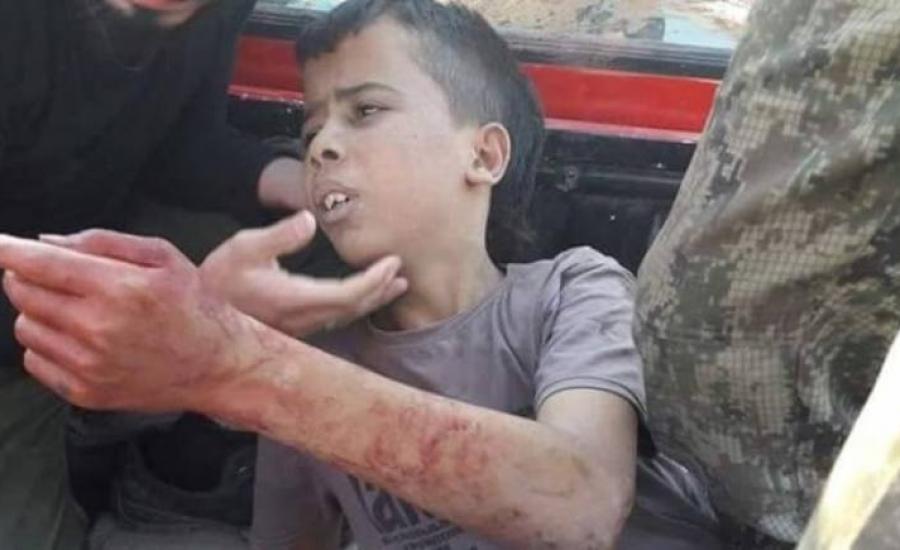 ذبح طفل فلسطيني 