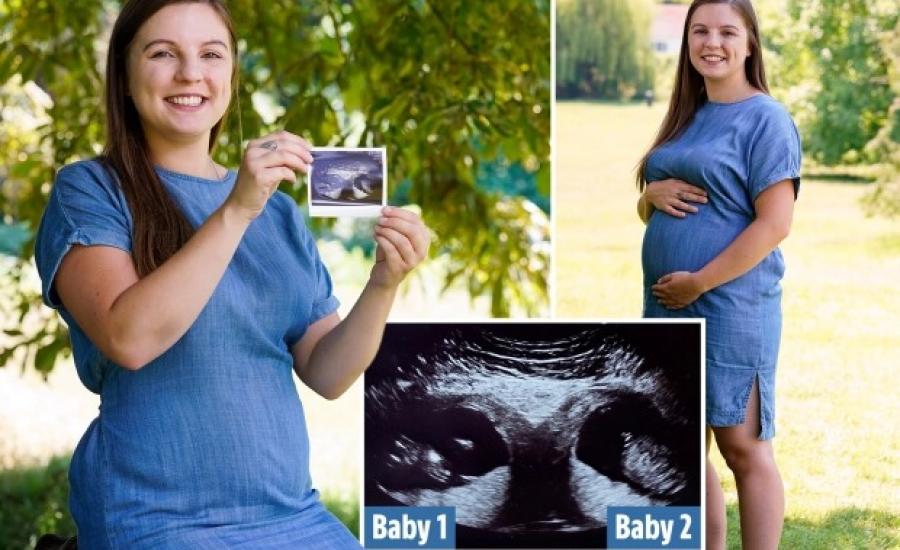 سيدة حامل بتوأمين في رحمين منفصلين 