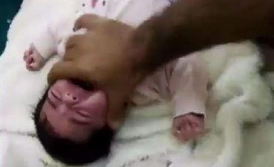 تعذيب طفلة سعودية 