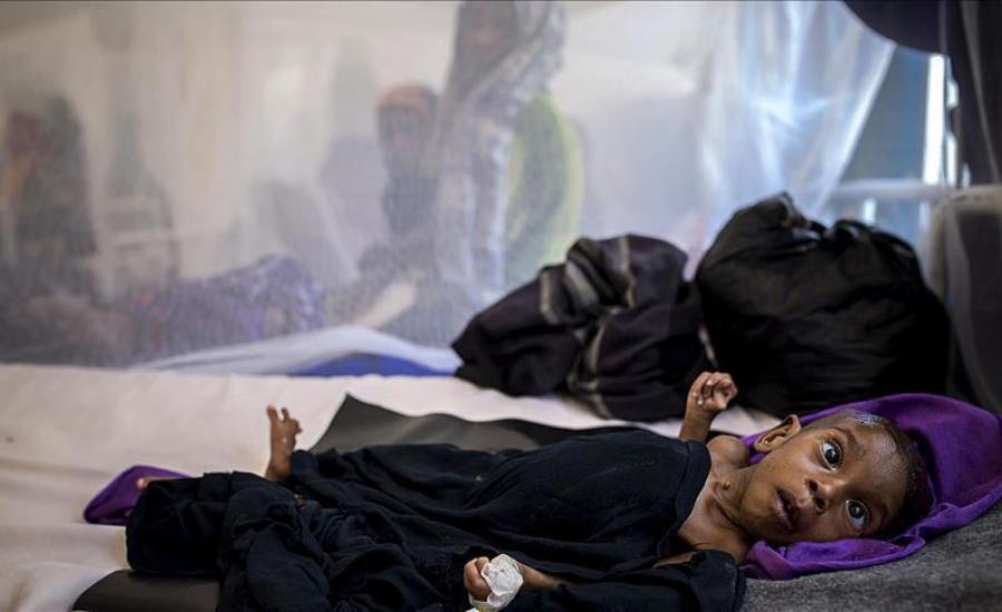 انفلونزا الخنازير في اليمن 