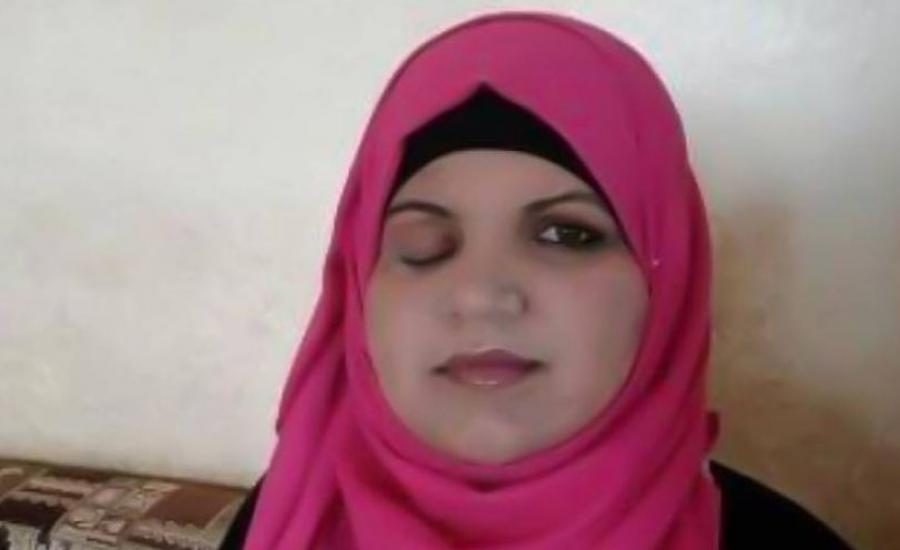 التقاط