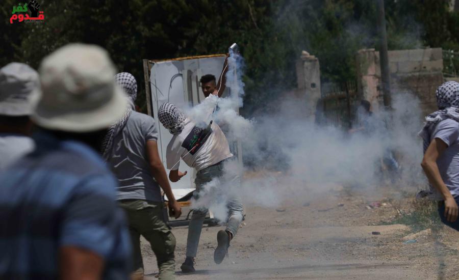 اصابات بقمع الاحتلال لمسيرة كفرقدوم 