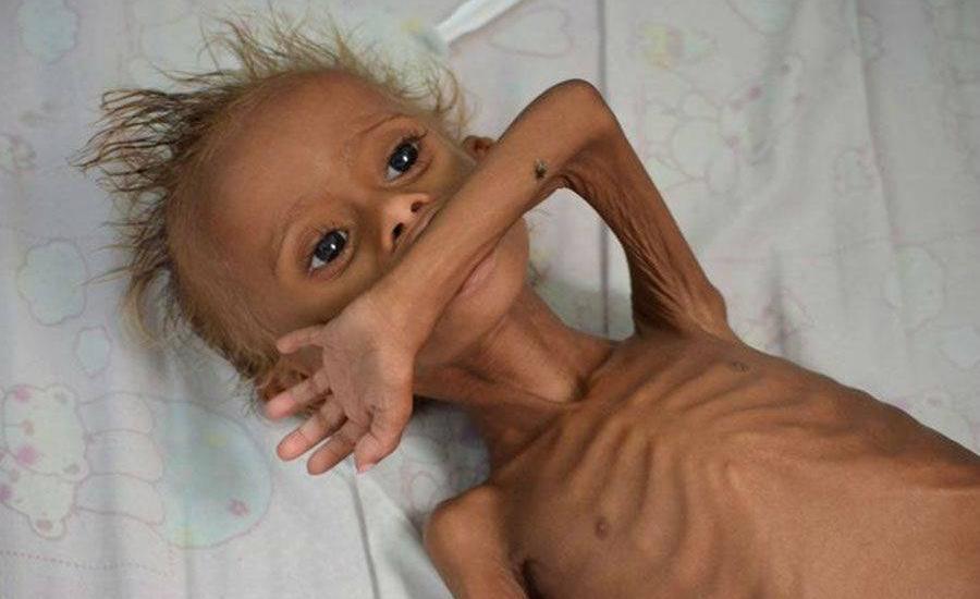 الاطفال في اليمن 