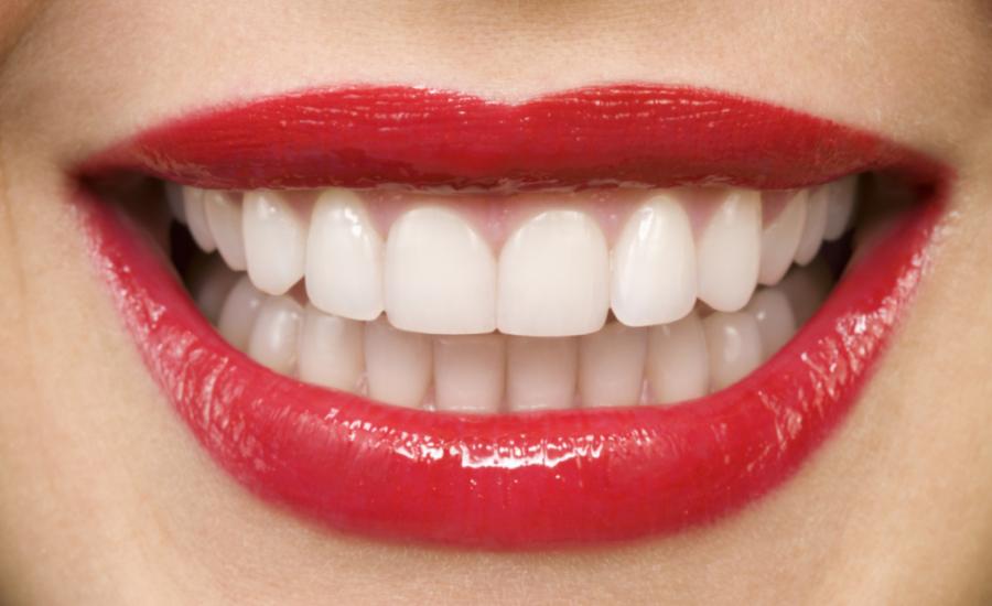 طرق الحصول على اسنان بيضاء 