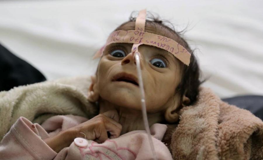 الامراض في اليمن 