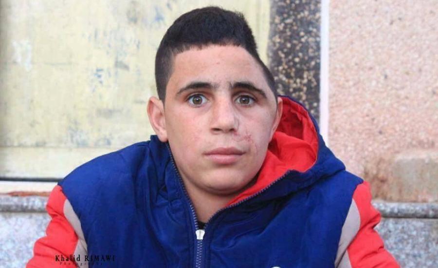 الاحتلال يخطتف الطفل الجريح محمد التميمي من النبي صالح