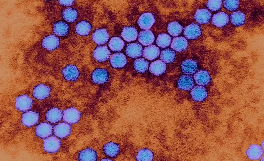 فيروس شلل الاطفال