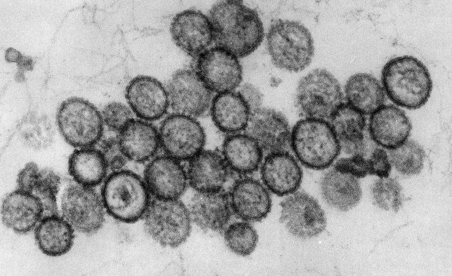 hantavirus.jpg